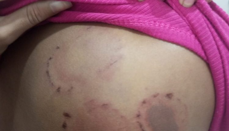 APÓS AGREDIR A COMPANHEIRA COM SOCOS E MORDIDAS, HOMEM É PRESO PELA POLÍCIA CIVIL EM PINHEIRO